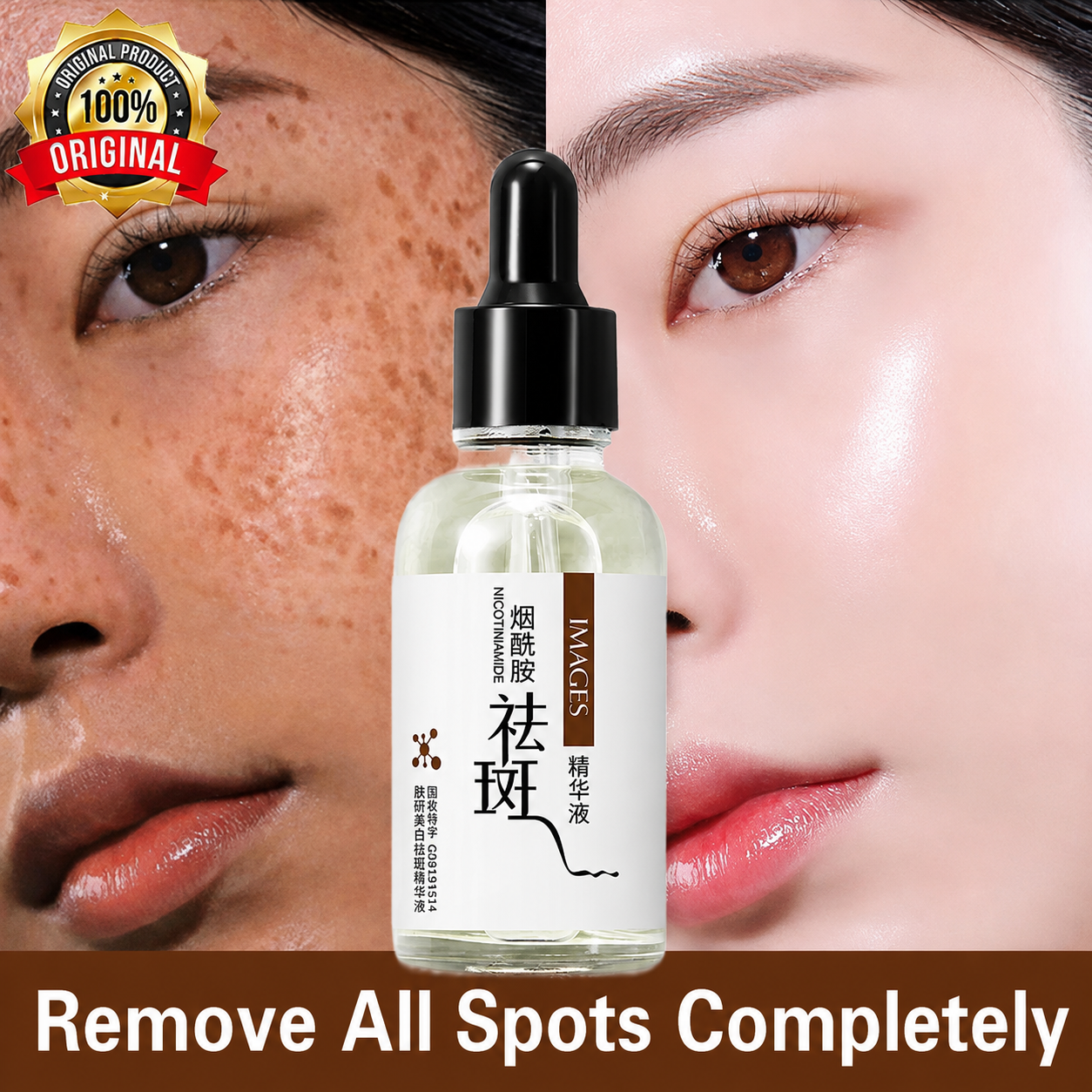 Original Freckles, Melasma, Dark Spots & Pigmentation Removing Brightening Serum