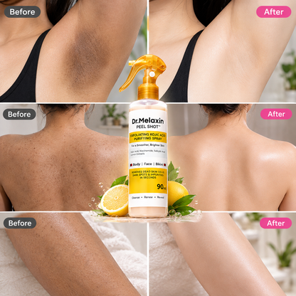 Peel Shot Body and Foot Exfoliating Spray Kojic Acid &amp; Turmeric 200 ml