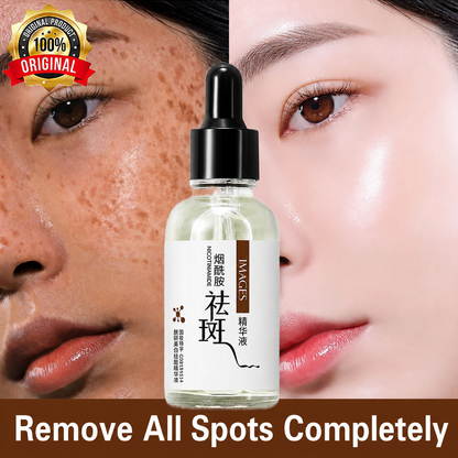 Original Freckles, Melasma, Dark Spots &amp; Pigmentation Removing Brightening Serum