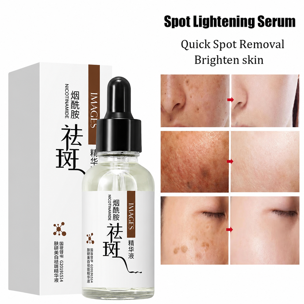 Original Freckles, Melasma, Dark Spots &amp; Pigmentation Removing Brightening Serum