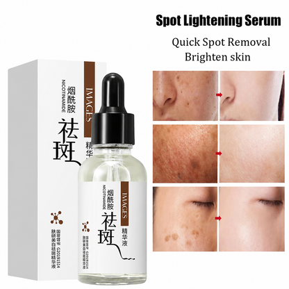 Original Freckles, Melasma, Dark Spots &amp; Pigmentation Removing Brightening Serum