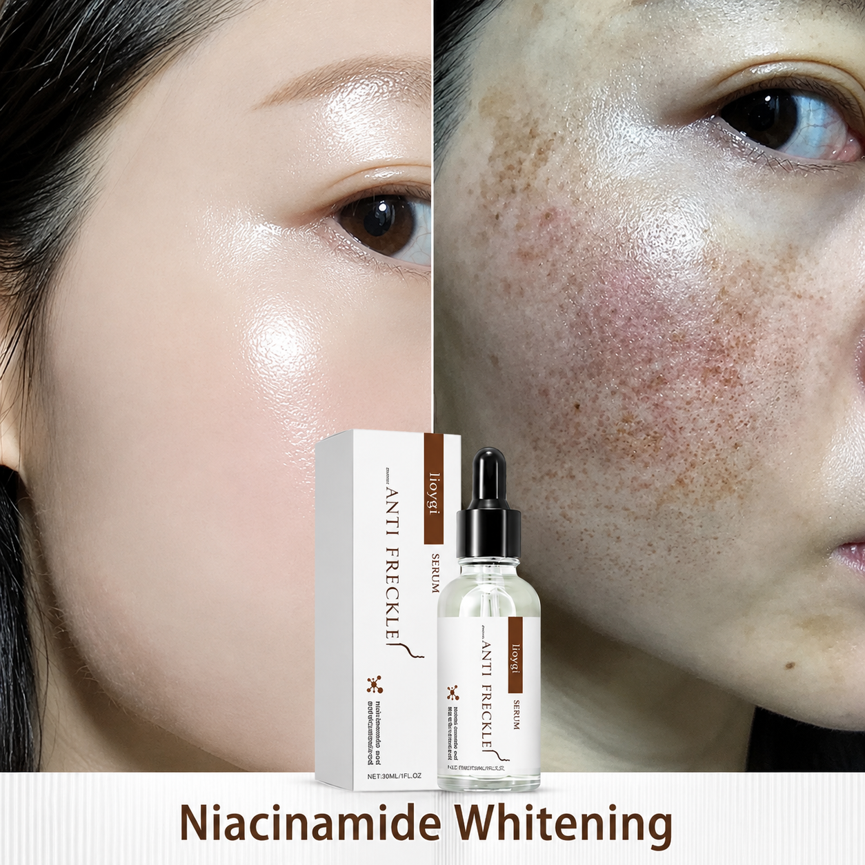 Original Freckles, Melasma, Dark Spots &amp; Pigmentation Removing Brightening Serum