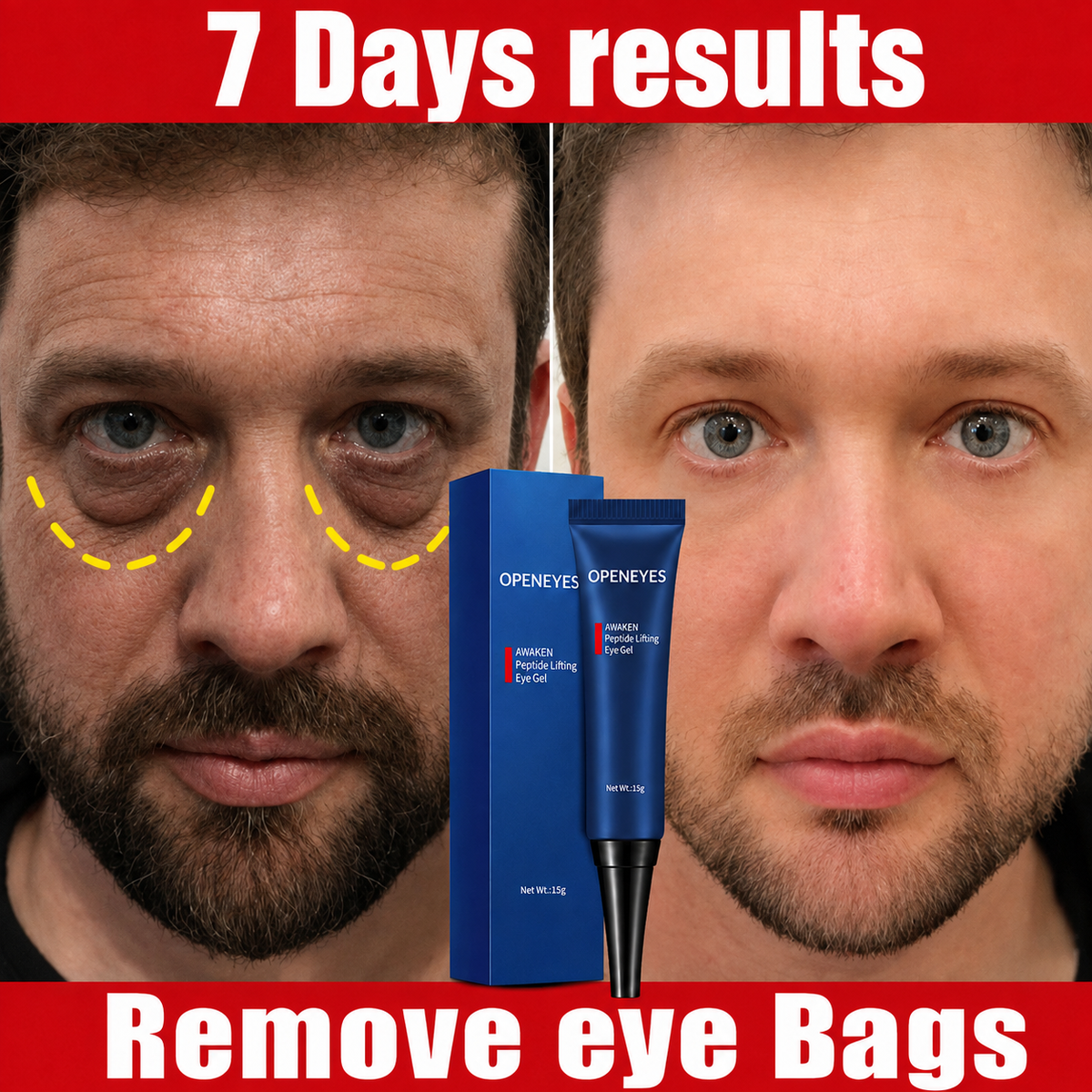 Original Imported Eyebags , Wrinkles &amp; Dark Circles Removing Eye Cream