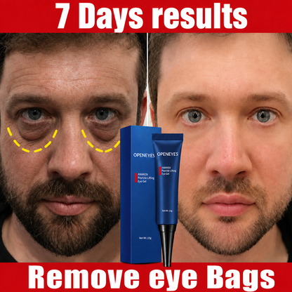 Original Imported Eyebags , Wrinkles &amp; Dark Circles Removing Eye Cream